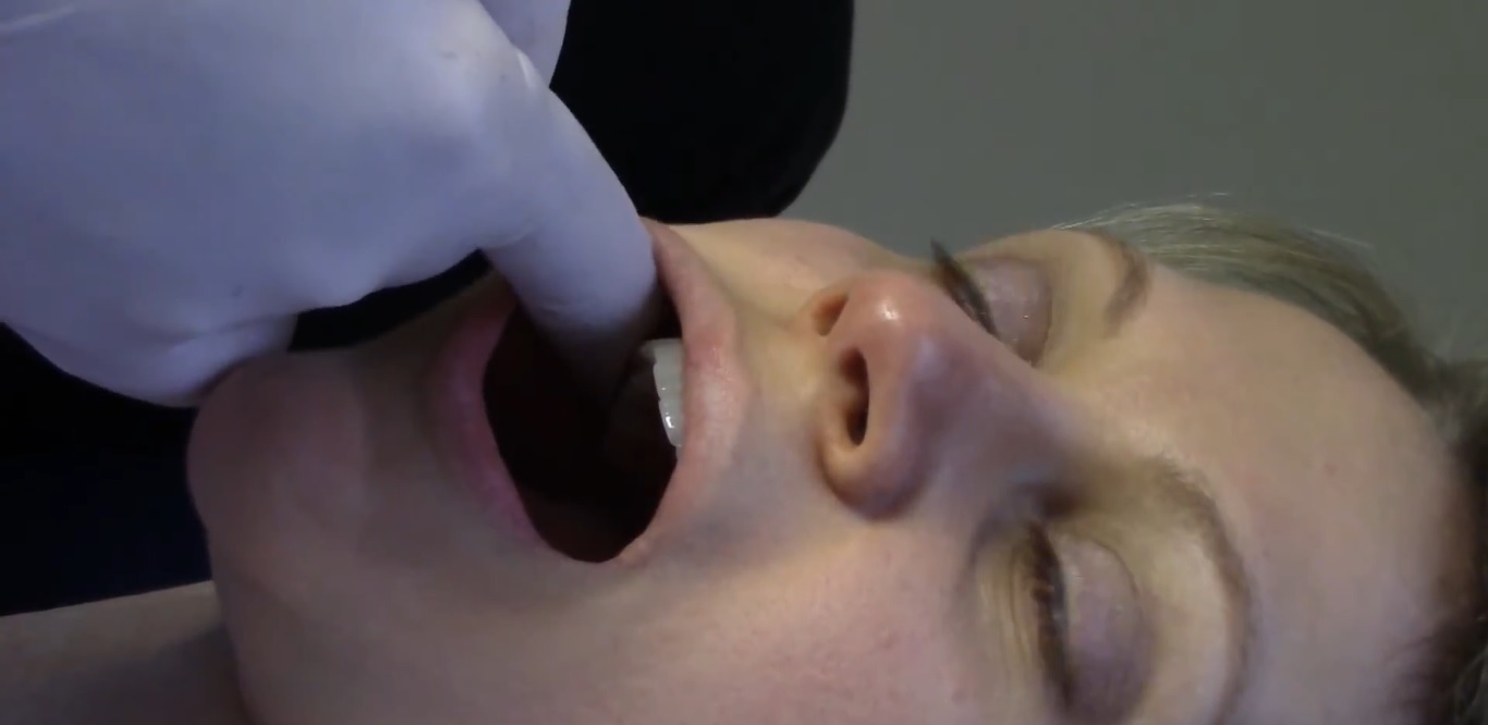 Consultation pour ATM et mâchoire à Lyon 2