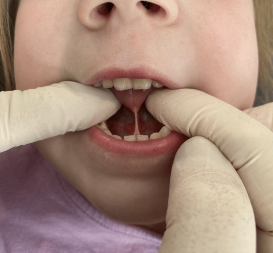 Cabinet d’ostéopathie dentaire à Lyon 2